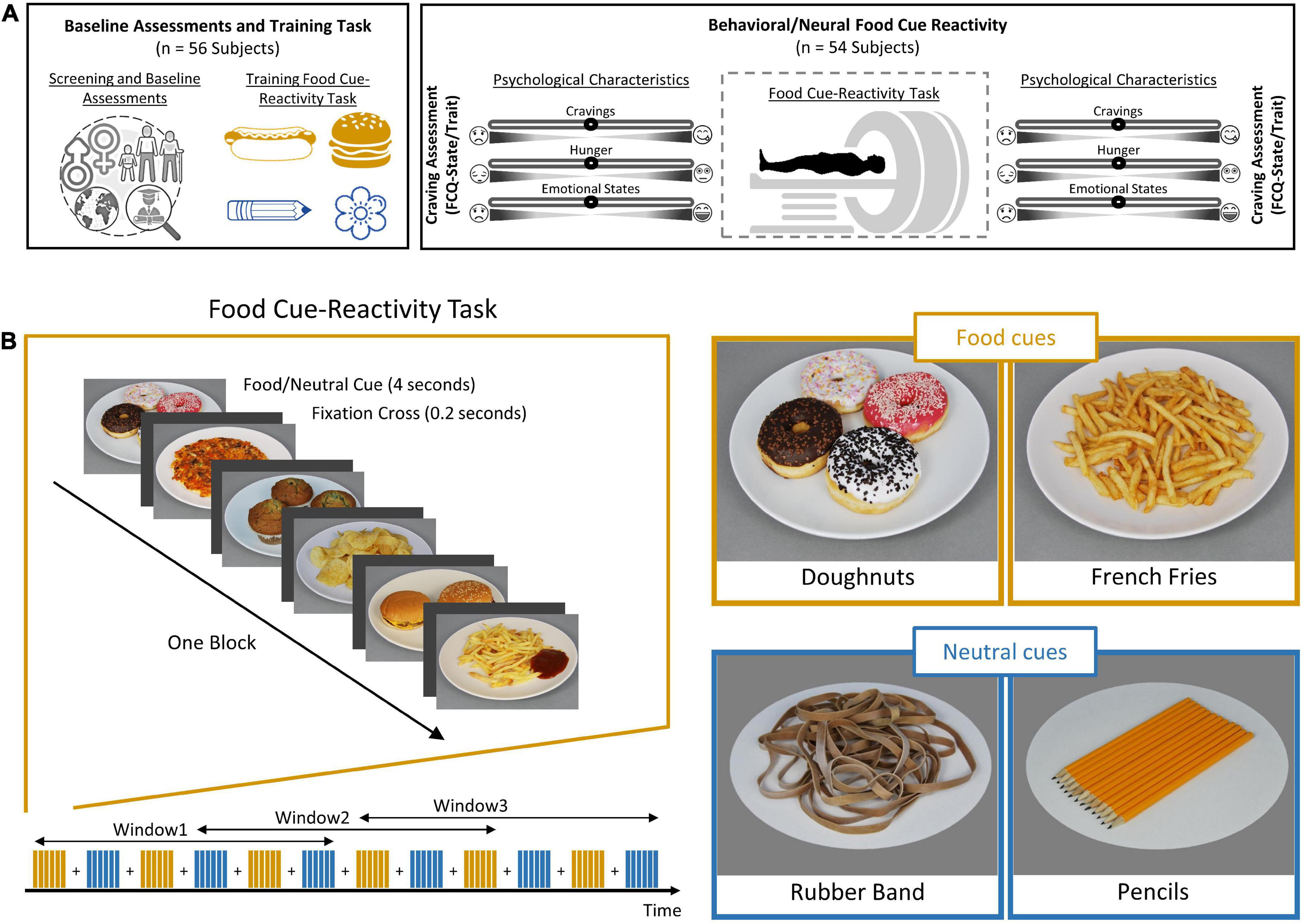 Habituation or sensitization of brain response to food cues: Temporal dynamic analysis in an functional magnetic resonance imaging study